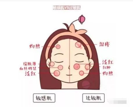 不同膚質(zhì)應(yīng)該如何正確護(hù)膚？