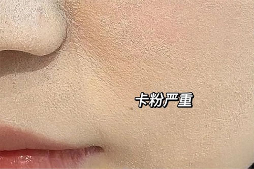 卡粉是什么意思？卡粉是什么原因引起的？